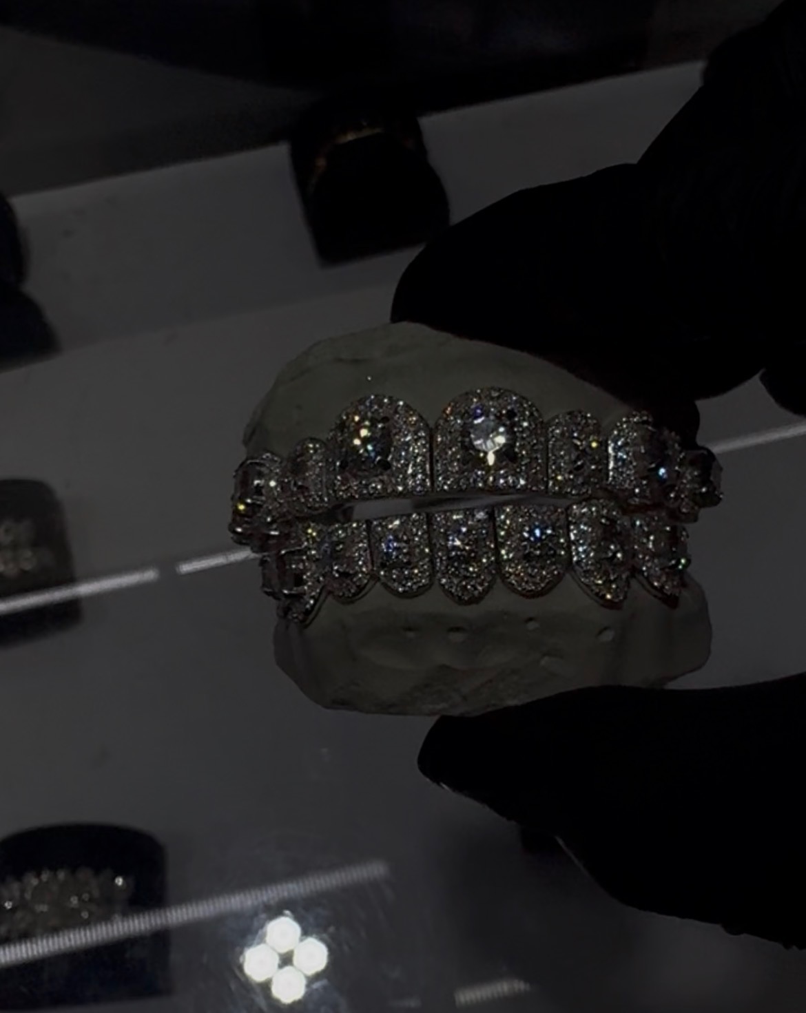 Iced-out diamond grill set on a dental mold